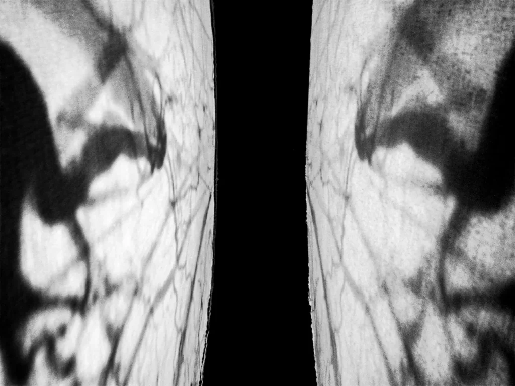 Na koła naciągnięty jest transparentny materiał i wyświetlane video, które przedstawia angioplastykę lewej tętnicy biodrowej
